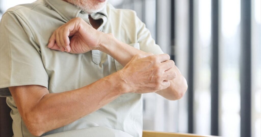 ネズミとダニ・アレルギーの関係