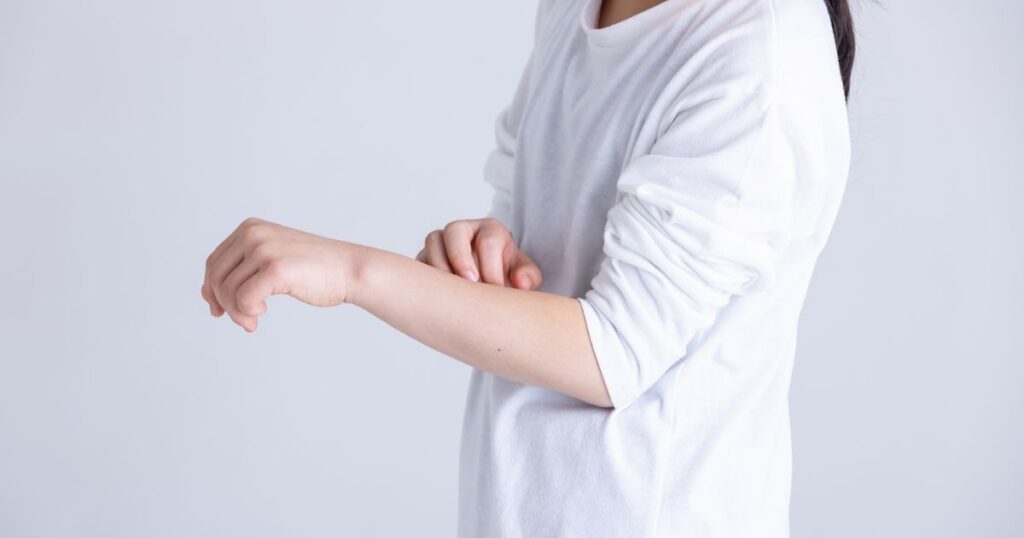 ネズミ由来ダニが引き起こす3つの被害